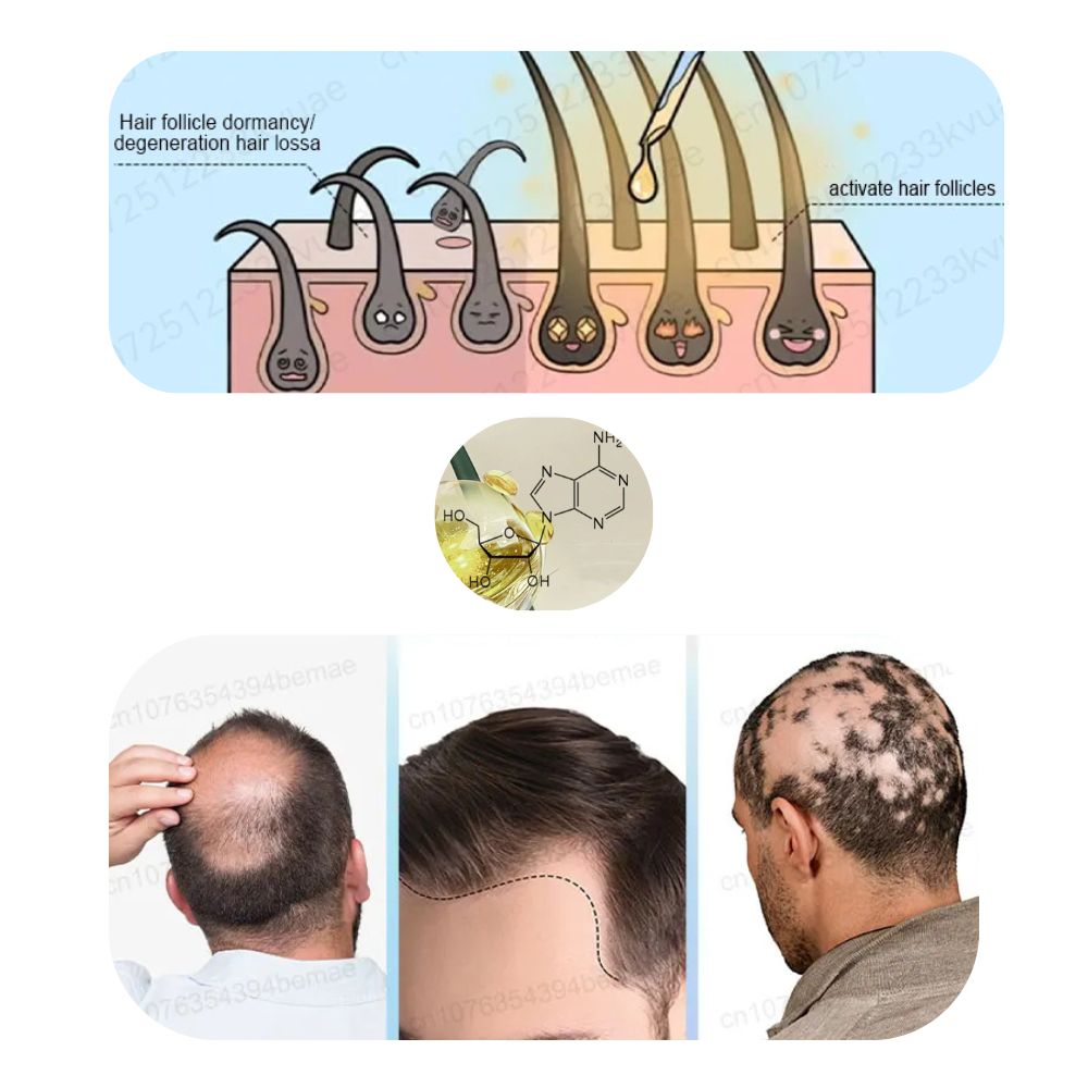 ADENOSIN Haarwachstumsserum | Schnelle Behandlung von Haarausfall bei erblich bedingter und seborrhoischer Alopezie